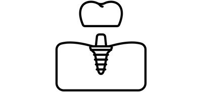 Image for Gum Implant Dental Cricut SVG Design