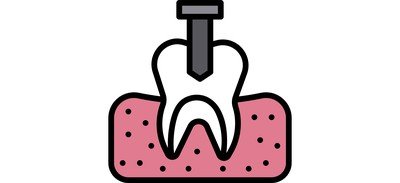 Image for Free Tooth Implant Crown Teeth Decay Cricut SVG Design