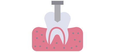 Image for Free Tooth Implant Crown Teeth Decay Cricut SVG Design