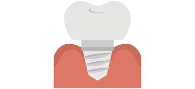 Image for Tooth Implant Dental Cricut SVG Design